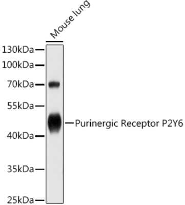 Western Blot: P2Y6/P2RY6 Antibody [NBP2-93862] - Western blot analysis of extracts of Mouse lung, using P2Y6/P2RY6 antibody (NBP2-93862) at 1:1000 dilution. Secondary antibody: HRP Goat Anti-Rabbit IgG (H+L) at 1:10000 dilution. Lysates/proteins: 25ug per lane. Blocking buffer: 3% nonfat dry milk in TBST. Detection: ECL Basic Kit. Exposure time: 1s.